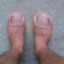 Toe, The First (Ultimate Toe)