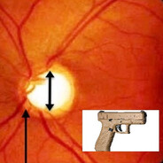 Glockoma