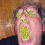 Mod of r/yeastinfection