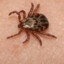 Lyme diseaseツ