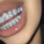 AdmistLOL