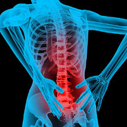 acute back pain