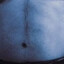 KIRK WINDSTEIN’S BELLY