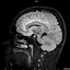 BRAIN