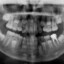 X-ray