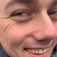 Nicks
