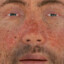 een