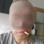 阿白