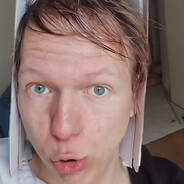 rezniksezacalvztekat