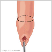 stulejkazprzerzutami
