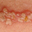 Leslarva Mornimf
