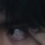 ojo con sarna