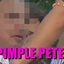 Pimple Pete