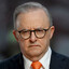 Anthony Albanese