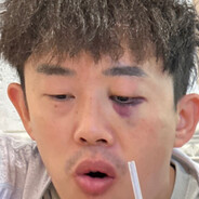 ACACACACACACACACACACACACAC