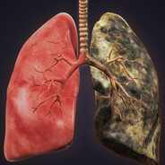 Black Lung