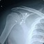 RationalBones