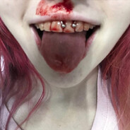 DOYOUWANTPAIN? QUE RICO SI