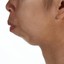 Leafys Chin