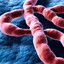 Ebola