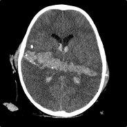 Hounsfield - steam id 76561197961459230