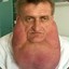 fatneck