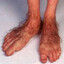 hairy hobbit toes