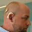 Cochlear Implant