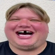 БЛЯДСКИЙ СИМПЛ