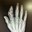 Finger Amputee