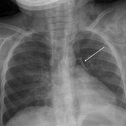 awoOooooooooooooooooooooooooookk