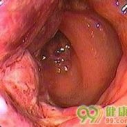 杀我的是大屁 眼