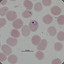 LEPTOSPIRA
