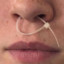RETTVAC