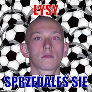 Jestem lysy bez nogizicase.pl