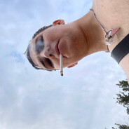 проблеми с шишкой