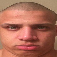 Tyler1's Head Dent