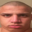 Tyler1&#039;s Head Dent