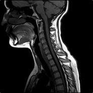 DEAD-ECHO - steam id 76561197971003388