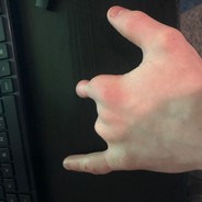 TysonNubs