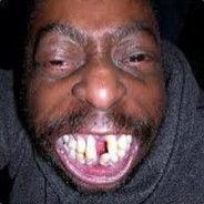XKINGADAM