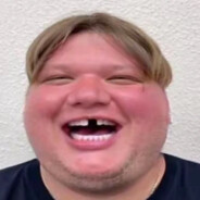 s1mple(navi青春版)