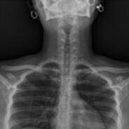 Авкинея Какалия