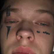 unstableenumb