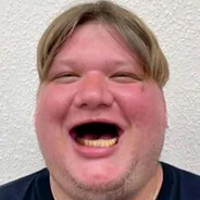 obesity