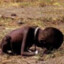 40 Lbs Starving African Child