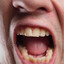 OralOracle