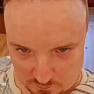 Jon (Male, 35 yrs, Denmark)