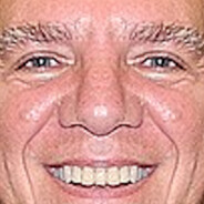 MetaBlud /!\ Noob avatar