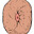 Puckered Sphincter